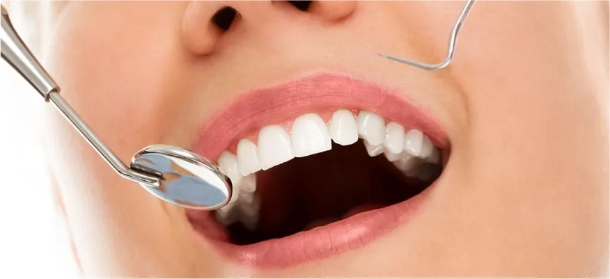 Dolgu Tedavileri Resim